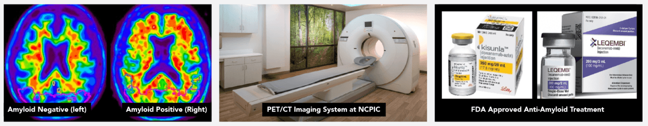 Amyloid PET/CT for referring physicians