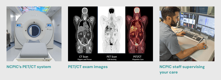 Exam Prep: FDG PET/CT