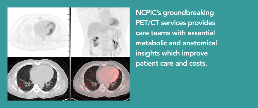 Side-by-side PET and CT scan comparison